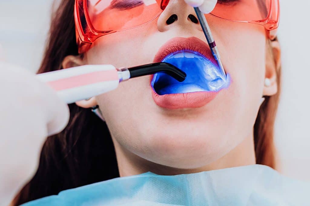 Dental Laser Treatment